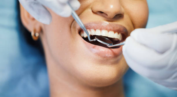 Best Emergency Dental Care for Broken or Chipped Teeth in Carol Stream, IL