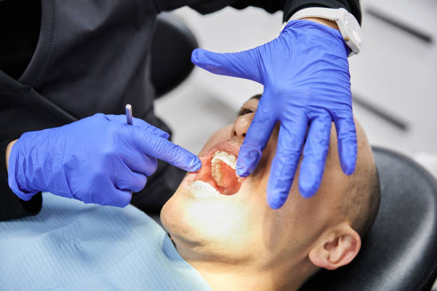 Best Emergency Treatment for Dental Infections or Abscesses in Carol Stream, IL