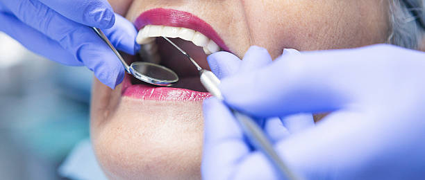 Best Emergency Dental Care for Broken or Chipped Teeth in Carol Stream, IL